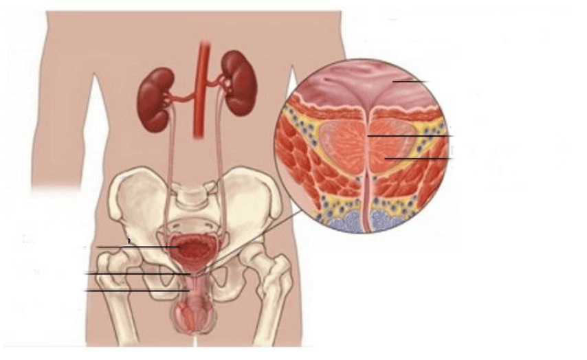 prostatitida u mužů